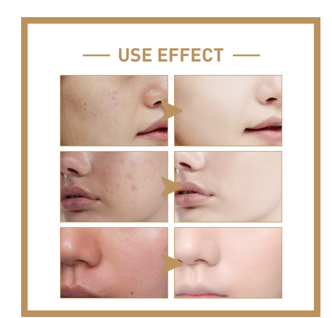 Toner de arroz I'M FROM 150 ml – hidratante y suavizante