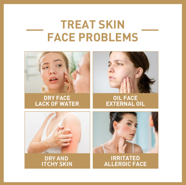 Toner de arroz I'M FROM 150 ml – hidratante y suavizante